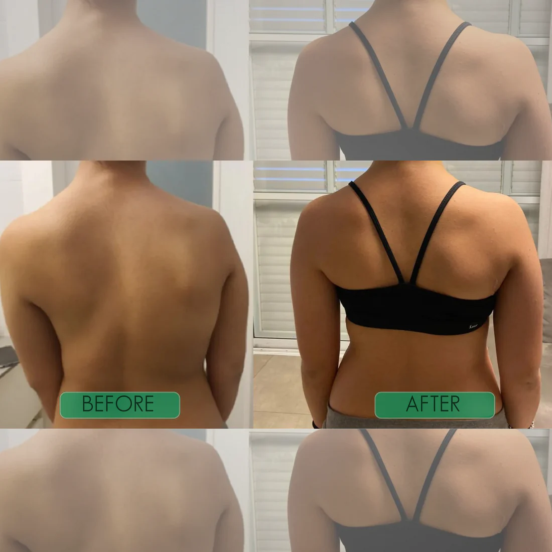 Instant Posture Corrector | Adjustable, Comfortable & Pain-Relieving