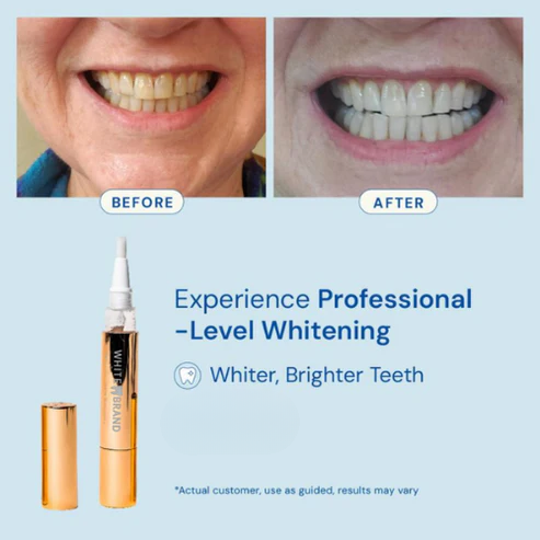 Extra-Strength Teeth Whitener Pen