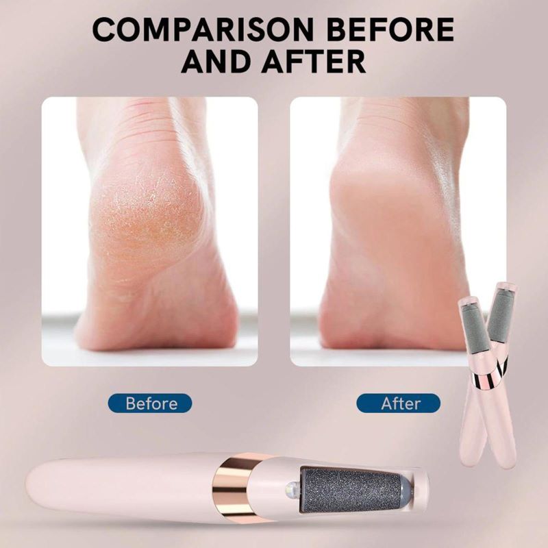 Electric Foot File Hard Skin Remover